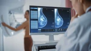 Profissional de saúde analisando imagens das mamas em um monitor enquanto paciente realiza o exame, representando a mamografia de rastreamento para prevenção e diagnóstico precoce do câncer de mama.
